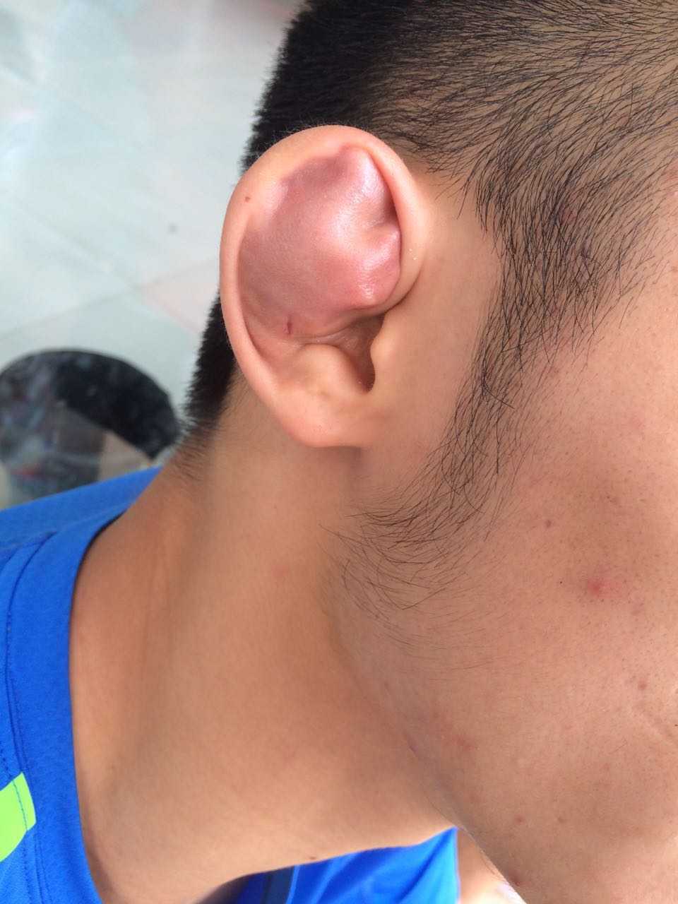 新鲜的摔跤耳 附赠蚕豆手 再附赠我韩哥的没脖子 姚哥的脖子和耳朵都