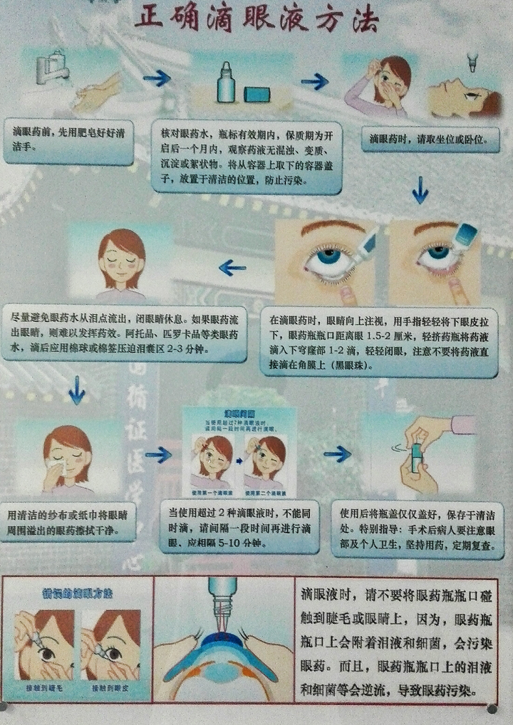 最正确的滴眼药水操作步骤是怎样的 知乎