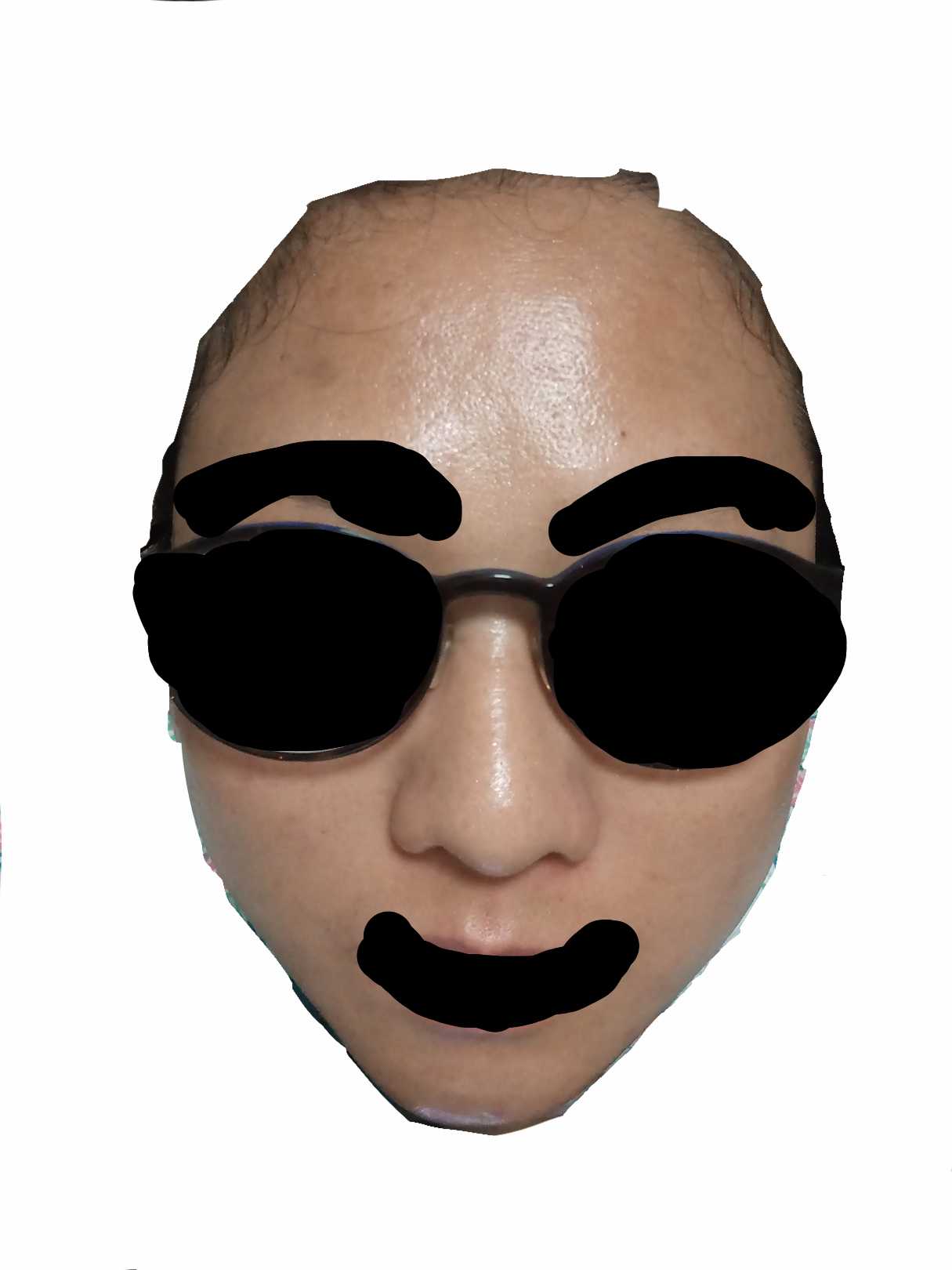 很得意! 我治好了自己的痘痘! …显示全部