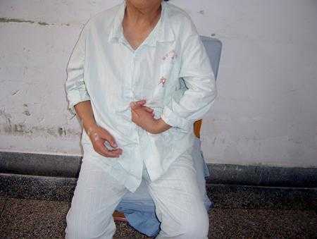 人如果神经过度紧张要紧吗,会不会引发其他神经方面的疾病?