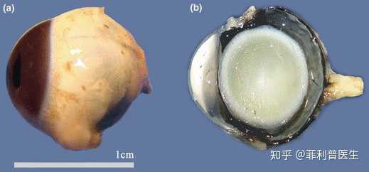 福尔马林固定的眼球标本,我不会告诉你这是人眼的,我怕吓到你