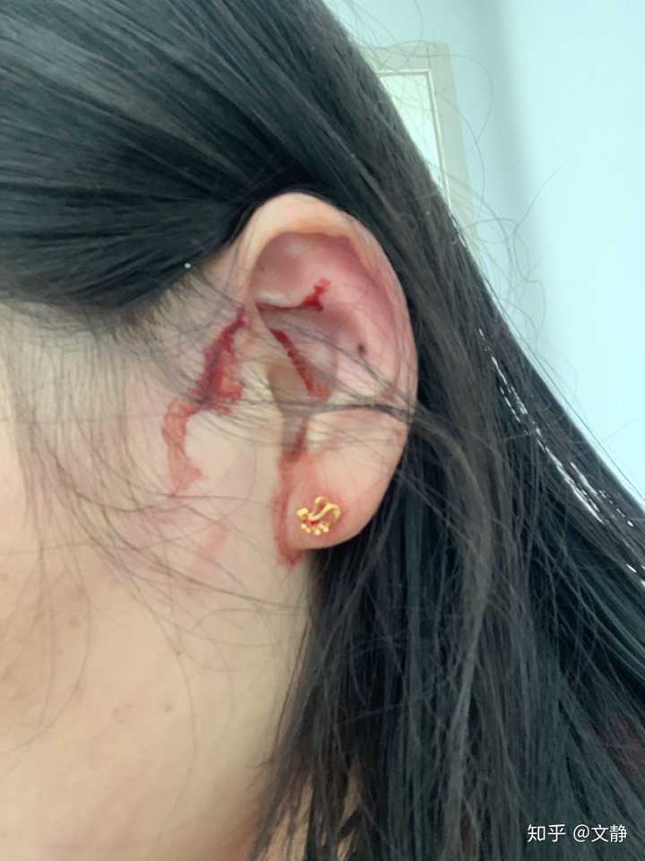 前天晚上,被猫抓了道血印子?