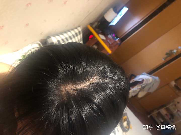 明明可以靠脸吃饭 却被痘痘逼得不得不靠实力是种什么体验 知乎