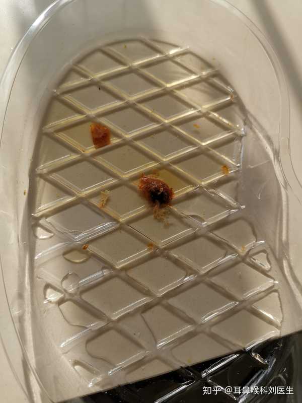 小孩耳朵家长该不该给她掏