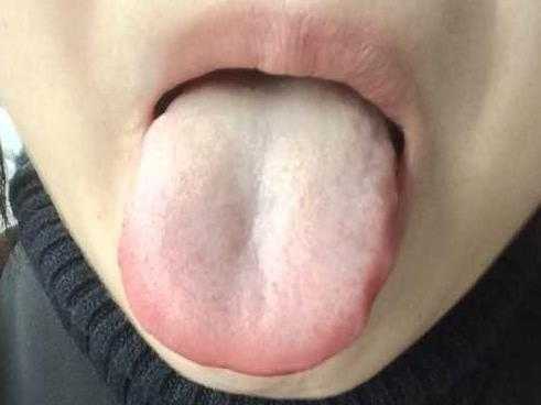 艾草肚脐贴真的可以祛湿减肥吗?附案例-守护佛网