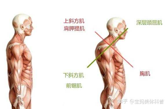 從肌肉角度講,上斜方肌,肩胛提肌,胸肌過於緊張,而深層頸屈肌,下