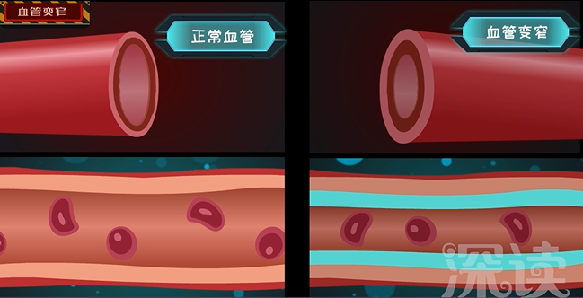 高血压具体有什么危害呢? - 知乎