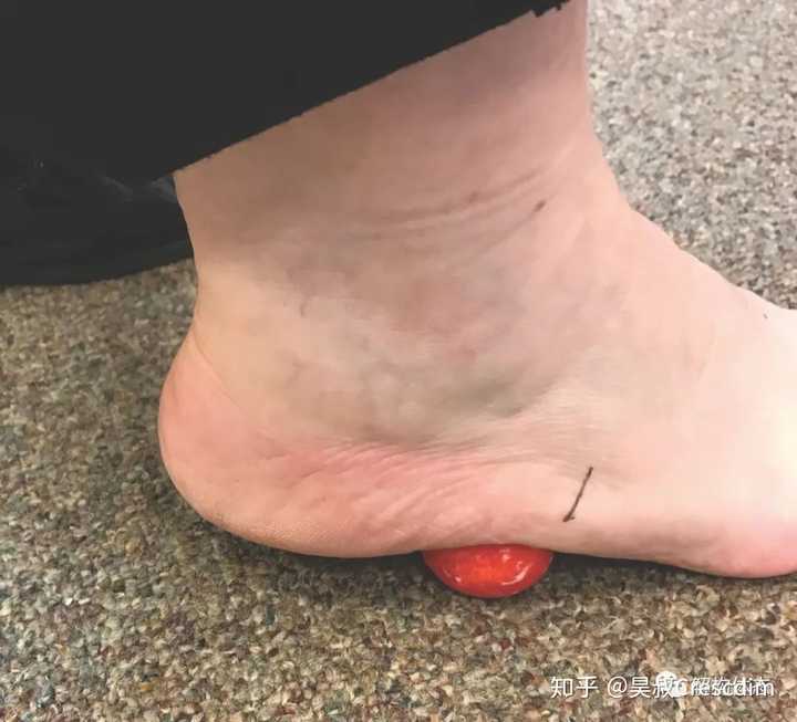 长跑步以后脚踝外侧偏下靠近脚板的位置疼,求解惑?