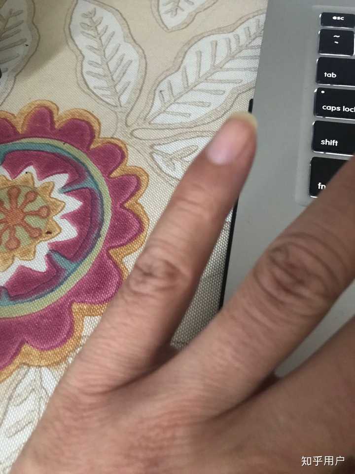 就是这个小拇指