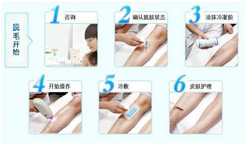 激光脱毛有哪些隐患 知乎