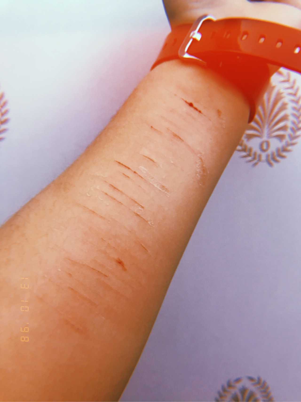 自残真的是一种精神的解脱嘛