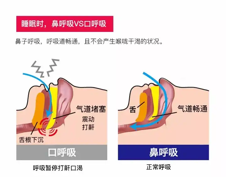 为什么晚上睡觉总用嘴巴呼吸 有什么危害吗 如何避免 知乎 为什么晚上睡觉总用嘴巴呼吸 有什么危害吗 如何避免 知乎