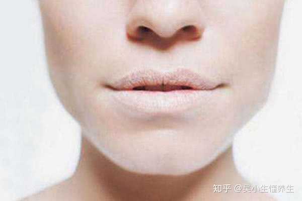 嘴唇发黑是怎么回事 知乎 嘴唇发黑是怎么回事 知乎