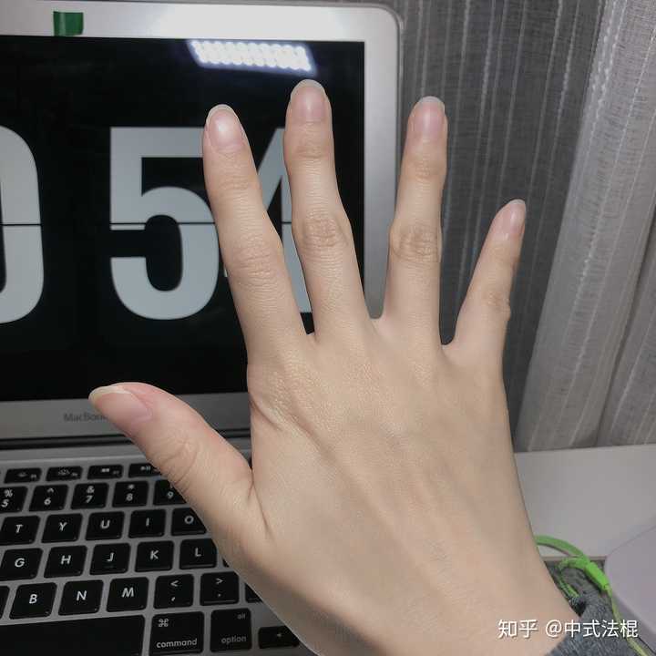 为什么左手食指的指甲也是歪的?
