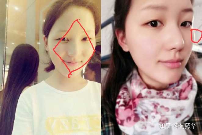 我是什么脸型呢 知乎 我是什么脸型呢 知乎