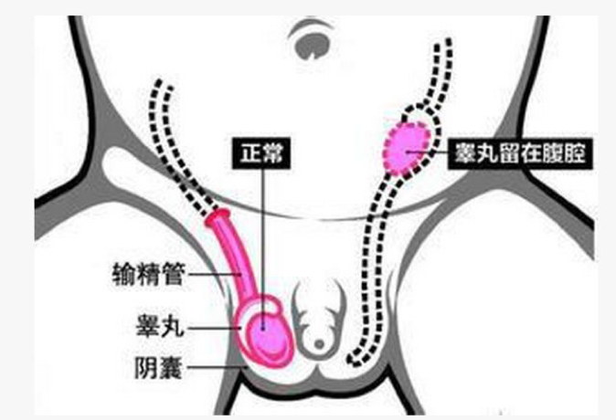 拔牙是利用什么原理_拔牙血凝块是什么样子