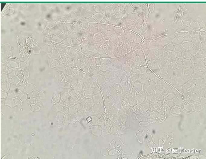 老一辈人说 脚气在土里走走就好了 有什么科学道理吗 医学easier 的回答 知乎