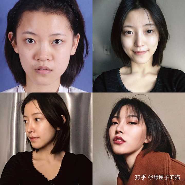 有在上海做过隆鼻的吗 戴传昌怎么样 知乎 有在上海做过隆鼻的吗 戴传昌怎么样 知乎