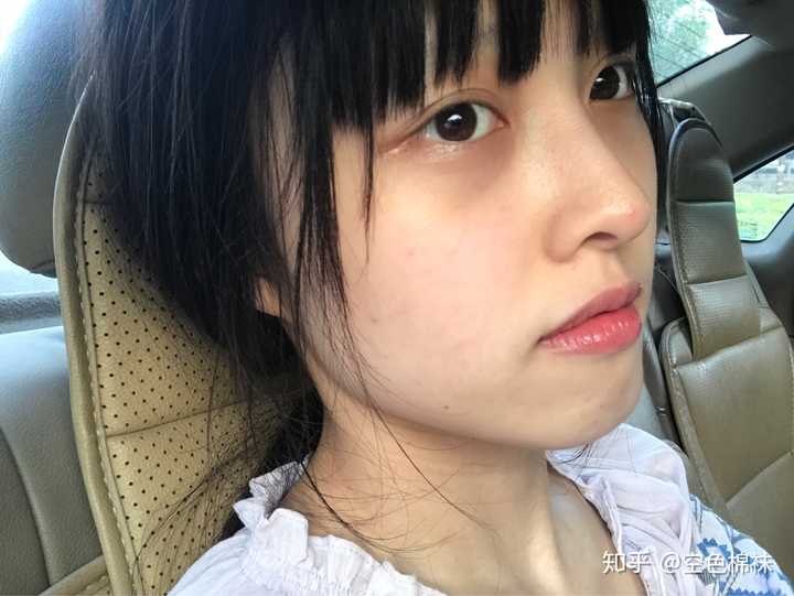 我哭了 发一些割之前的照片 其实以前是一边单眼皮一边多层眼皮,贴双