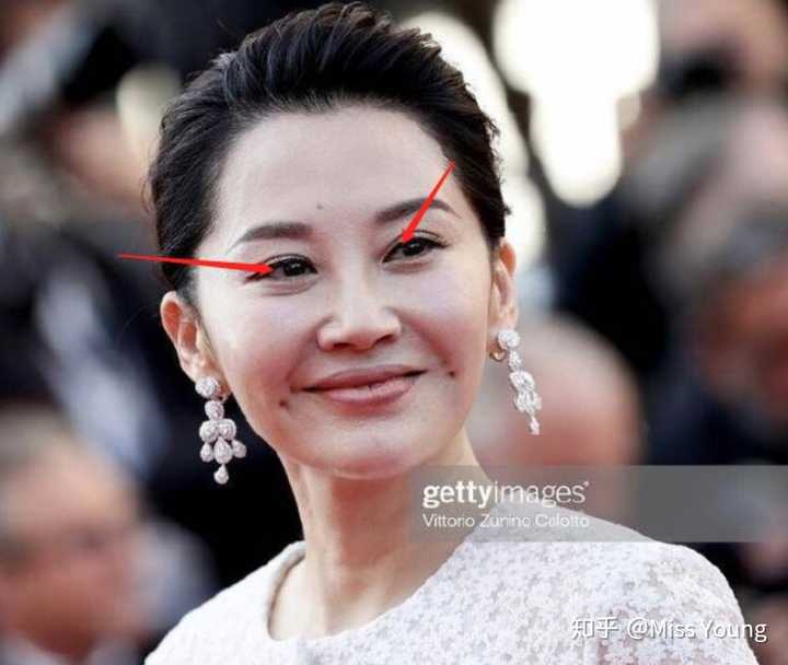 眼白为什么越来越浑浊 越来越黄 有什么方法让眼白白亮起来呢 知乎 眼白为什么越来越浑浊 越来越黄 有什么方法让眼白白亮起来呢 知乎