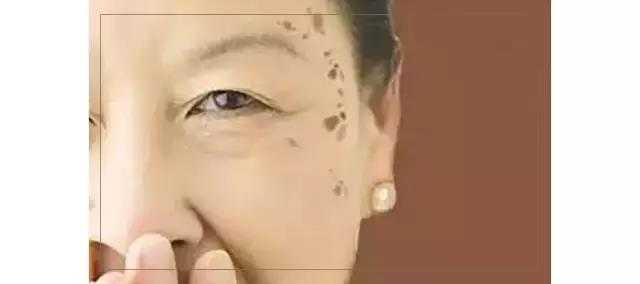 怎么才能去掉脸上的色斑 肤泊漫祛斑霜的回答 知乎 怎么才能去掉脸上的色斑 肤泊漫祛斑霜的回答 知乎