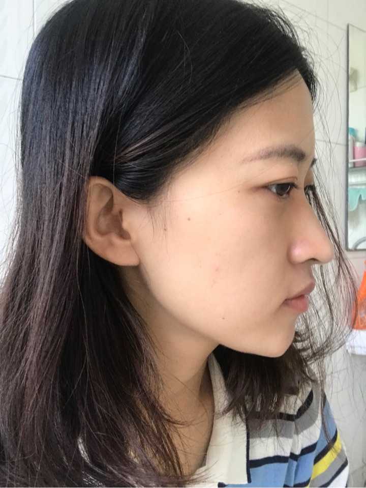 鼻子太挺拔有什么体验?