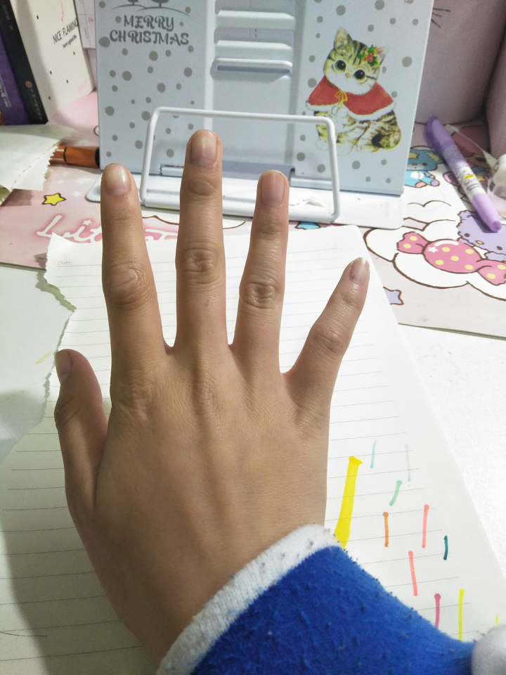 拥有一双不好看的手是种怎样的体验?