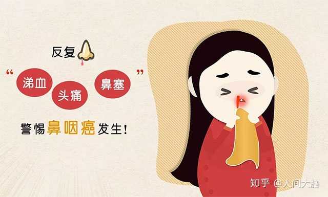 怎么判断自己得了鼻炎还是鼻咽癌 知乎