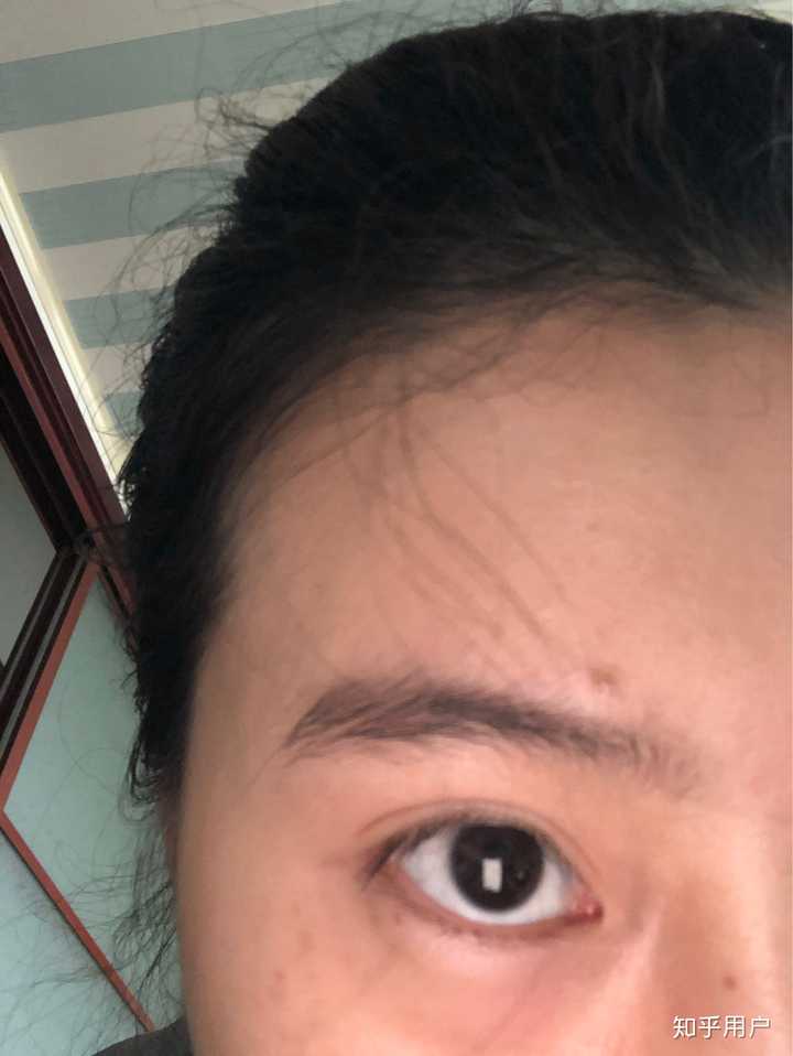 你身边有哪些整容失败的例子 知乎 你身边有哪些整容失败的例子 知乎