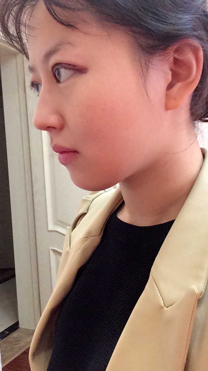 鼻子挺是种怎样的体验?