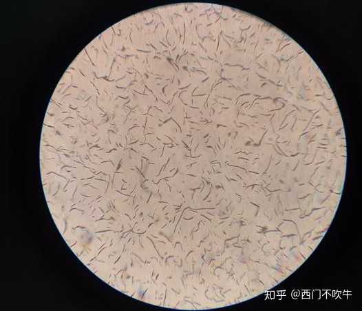 灰铸铁金相 100倍放大基体组织