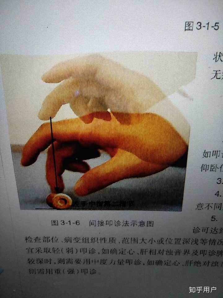 还有西医的叩诊,除了要听叩诊音之外,还有用手感觉局部震动的差异的