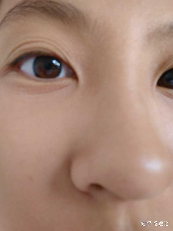 多眼皮是种什么体验?