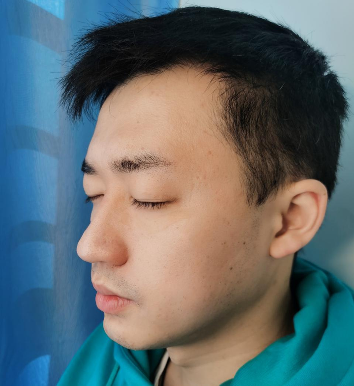 如何去眼袋 知乎 如何去眼袋 知乎