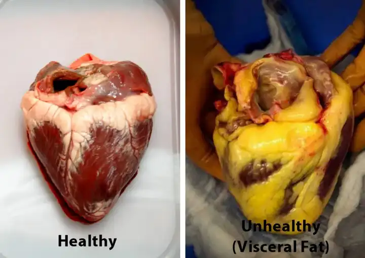 肚子一直圆鼓鼓的内脏脂肪要怎么减