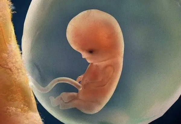 人类的身体存在哪些bug?