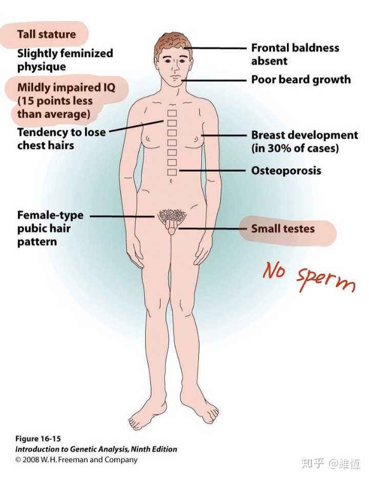 作为一名xyy患者或xxy患者是怎样的体验 知乎