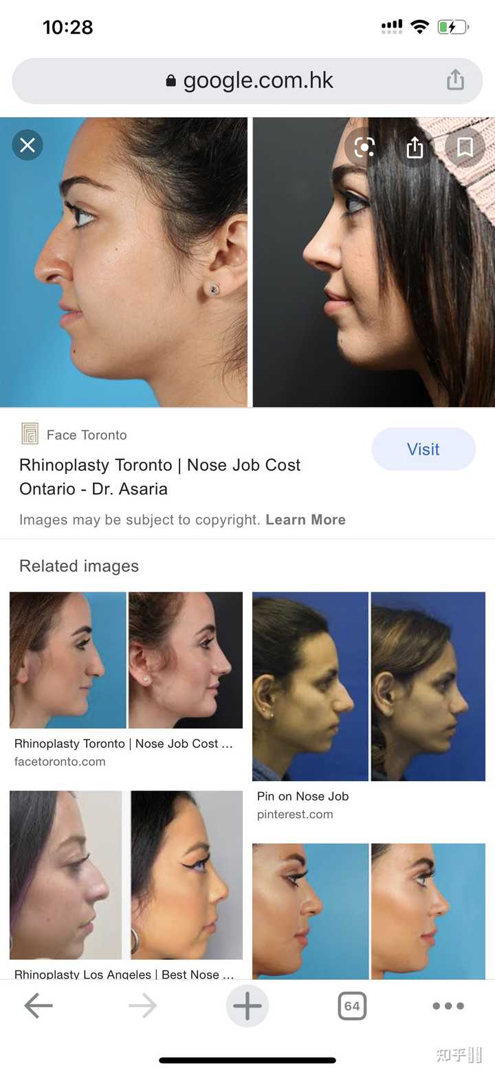 欧美白人或者中东白人整形的话一般是整哪里 知乎