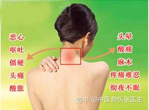 颈椎病的症状有哪些 知乎 颈椎病的症状有哪些 知乎