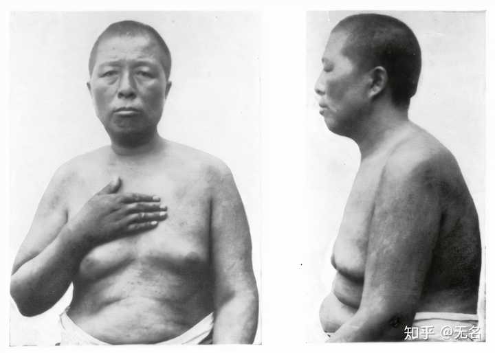 鸡被阉了体型会变大 太监 印象里 为什么体型不是变大反而瘦小 知乎