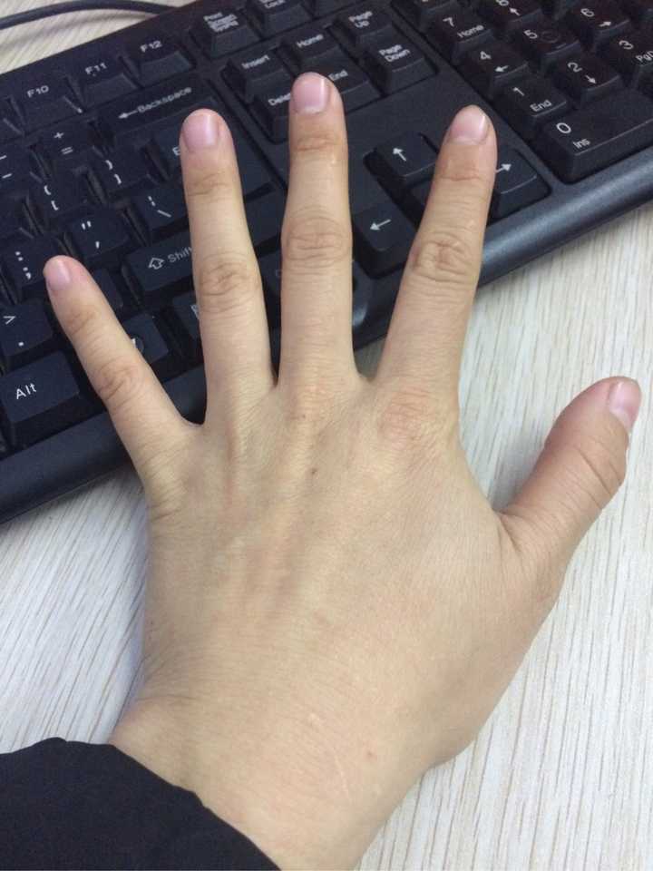 女孩子手长得丑,关节大且扭曲之类的,像枯枝一样是什么体验?