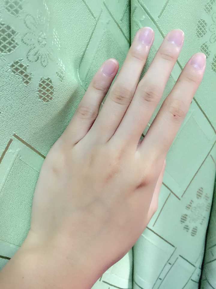 年纪轻轻23岁手上皮肤就很干有很多皱纹,像老年人干瘪的手,怎么办呀?