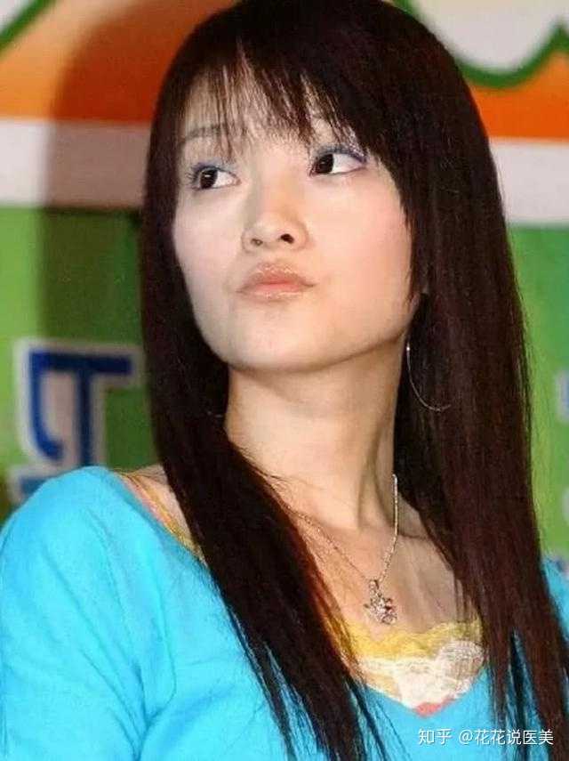 为什么整容一眼就能看出来?