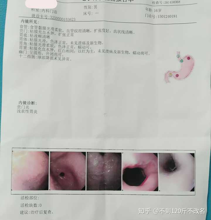 得了胃炎是一种怎样的体验 知乎