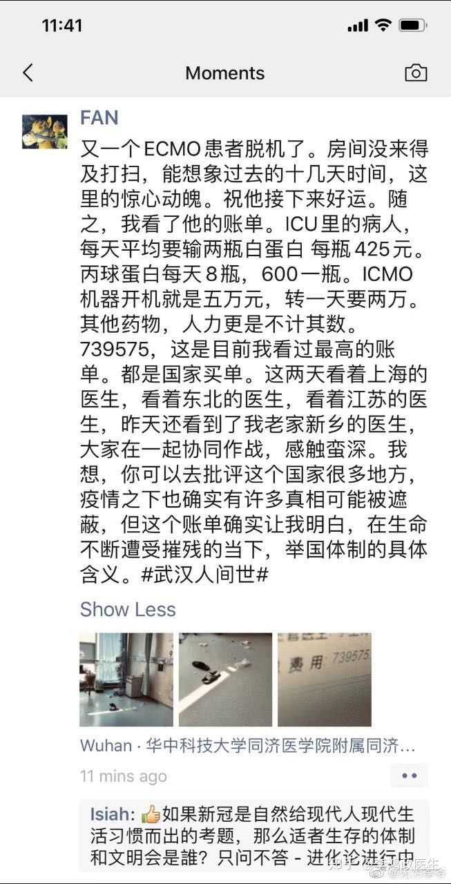 叶克膜 Ecmo 是一种什么技术 知乎 叶克膜 Ecmo 是一种什么技术 知乎