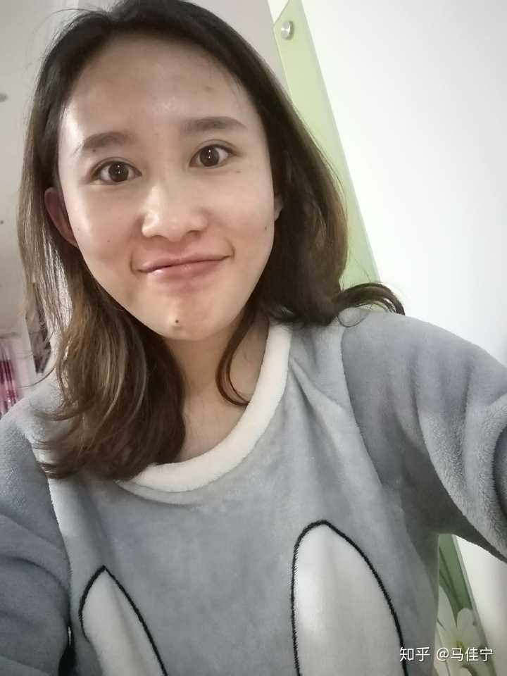 女生大饼脸怎么破?