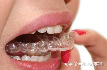 合肥箍牙多少钱?