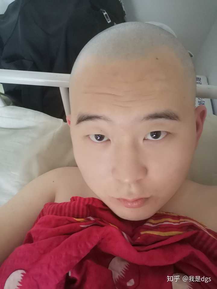剃光头对自身有什么坏处 知乎 剃光头对自身有什么坏处 知乎