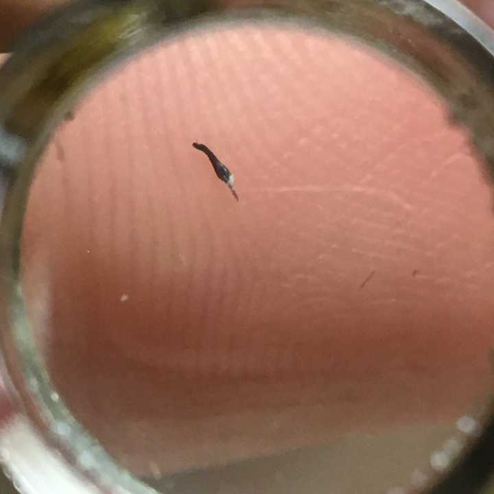 从肉里面抠出一个黑色像种子一样很硬的东西是什么原因?