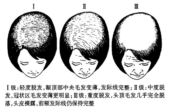 三级脱发三型图片